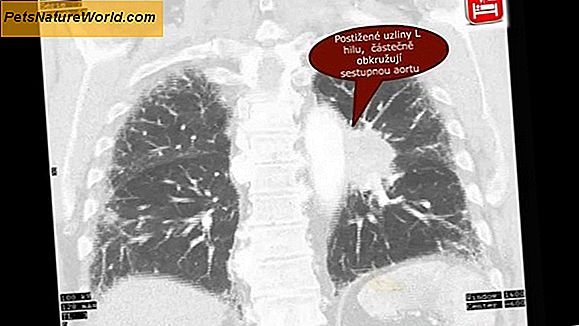 Rakovina plic kousků