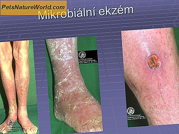 4 Nejčastější kožní alergie na kůži