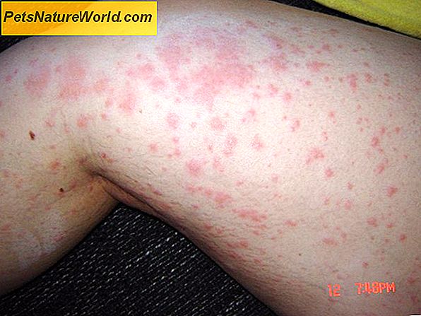 Kožní infekce kůže s Cephalexin