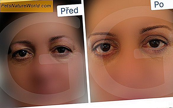 Korekce čerešňového oka s chirurgickým zákrokem