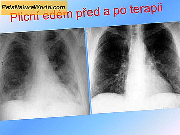 Běžné choroby a příznaky plic