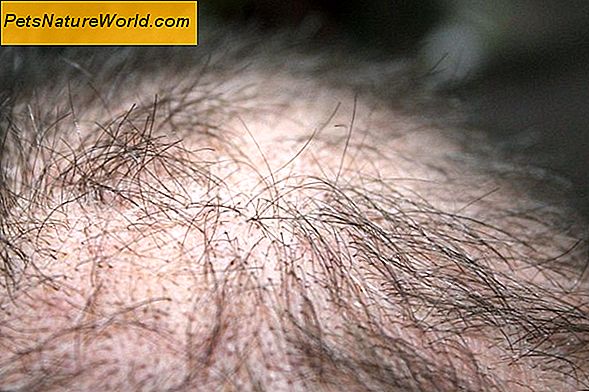 Alopecia Areata hos hunde