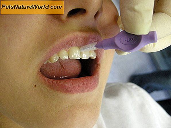 Reinigung der Zähne zur Vermeidung von Zahnfehlern