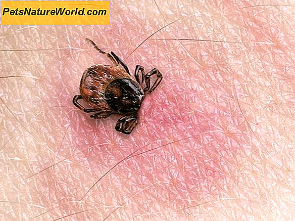 Sintomi simil-influenzali: Malattia di Lyme scambiata per influenza