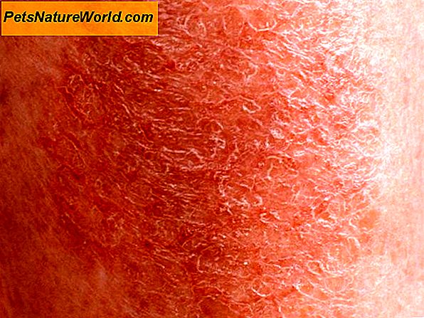 Behandeling van huidaandoeningen bij de huid