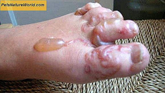 Loppe allergi dermatitis hos katte