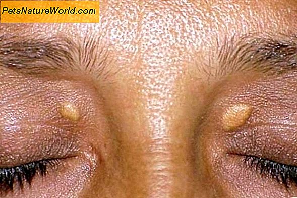 Симптоми обичних проблема са очима око очију