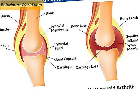 Artrit / Bone och Joint Disease